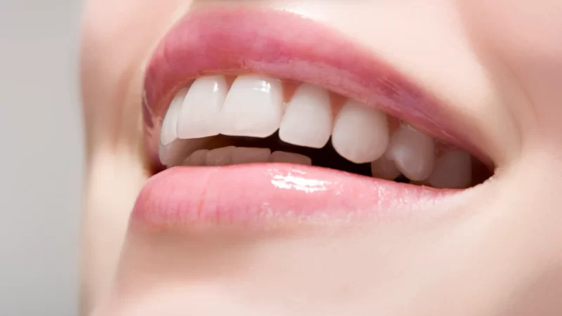 5 Surprising Benefits of Whiter and Brighter Smile